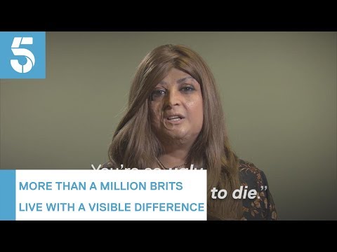 More than a quarter of people with a facial disfigurement experience hate crime | 5 News