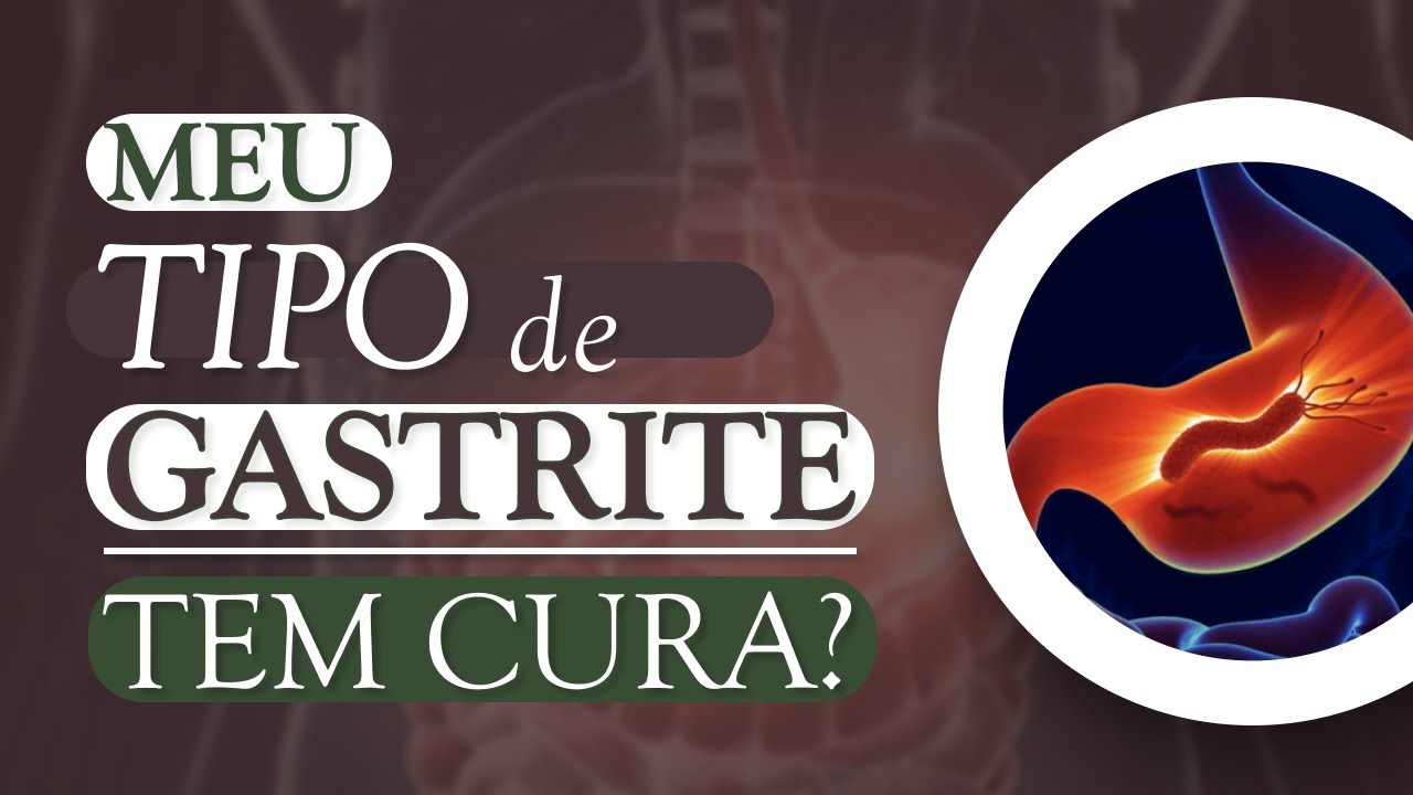 QUAIS TIPOS DE GASTRITE TEM CURA? | Carlos Naturólogo - YouTube