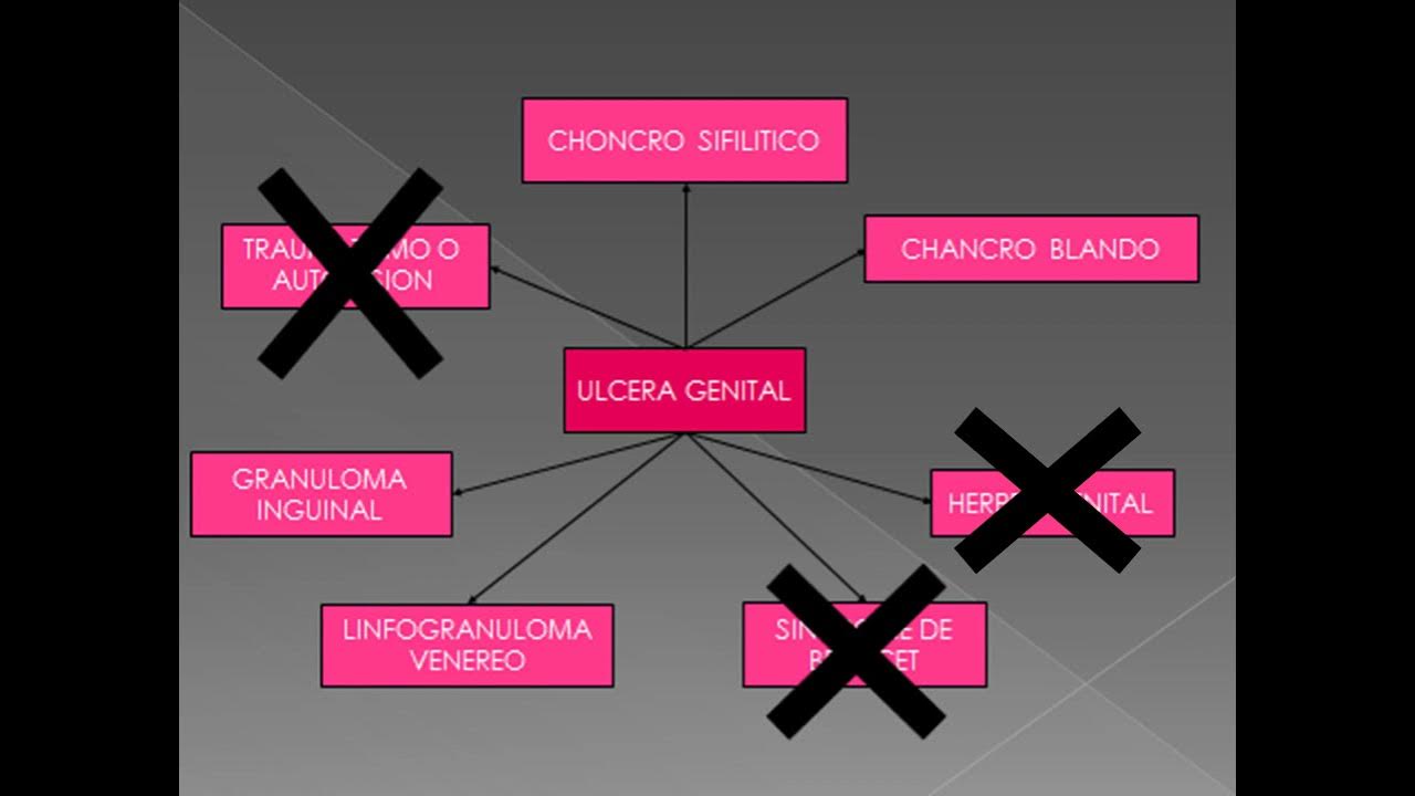 Diferencia entre moldeador y permanente