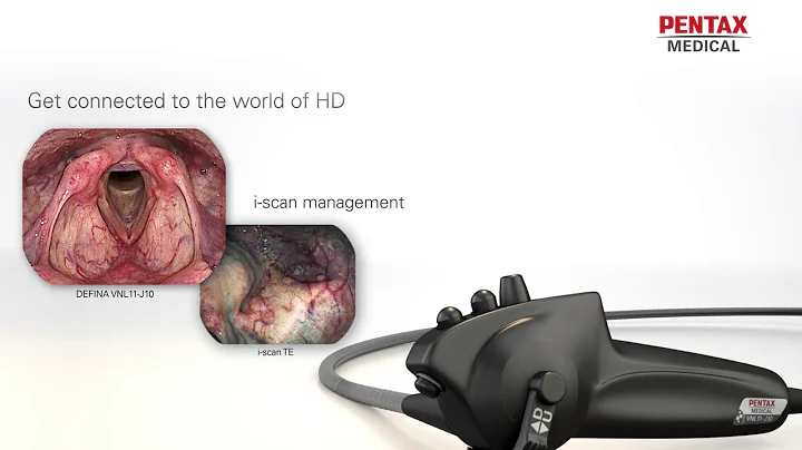 DEFINA ENT J10, by PENTAX