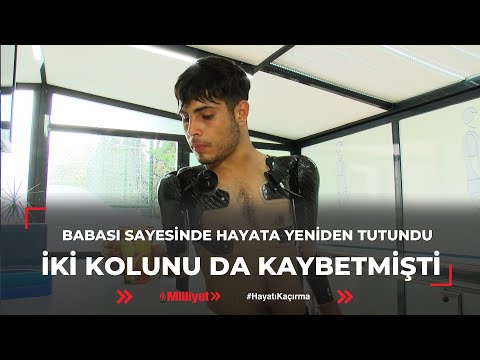 İki kolunu da kaybetmişti, babası sayesinde hayata yeniden tutundu