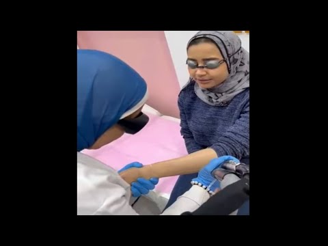 عرض ازالة الشعر بالليزر باستخدام جهاز ديكا ازالة الشعر بجهاز ديكا ام جهاز كانديلا ليزر كانديلا