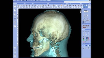 Using Object Browser in Planmeca Romexis® 3D module