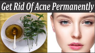 Get Clean And Clear Skin | Blood Purifier | How to Remove Pimples remedy | Remove Acne Naturally