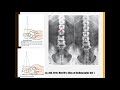 29+ Anatomi Radiologi Lumbal