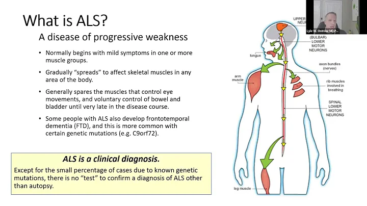 Interpreting Clinical Trials Webinar with Dr. Lyle Ostrow