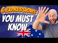 6 English Expressions You Need to Know | Aussie English