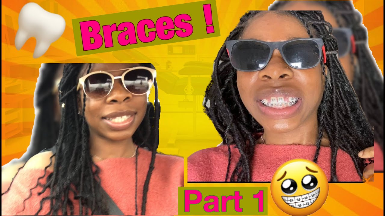 2021 Come Get Braces W/ Me!!!  |(Vlog PT 1)