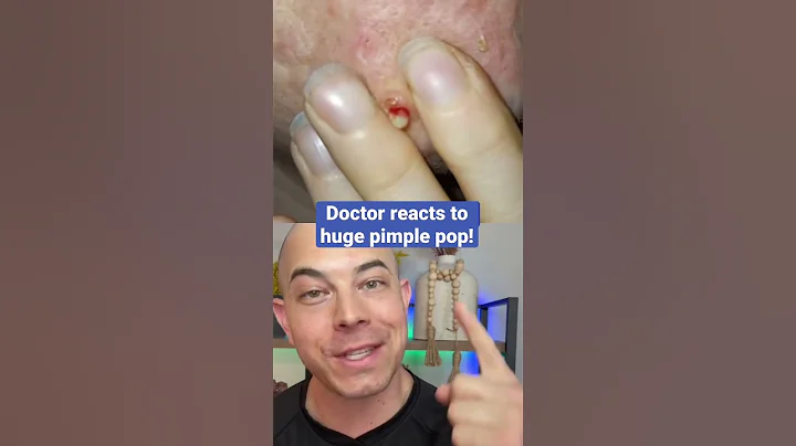 Doctor reacts to huge pimple pop!💥
