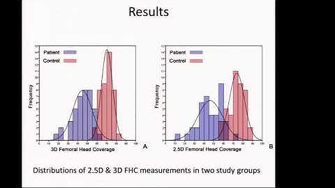 G. Zheng, Statistical shape modeling of the dysplastic hip, Hip Symposium 2016