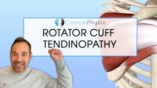 Rotator Cuff Tendinopathy | Expert Explains Mechanism Of Injury and Rehab Plan