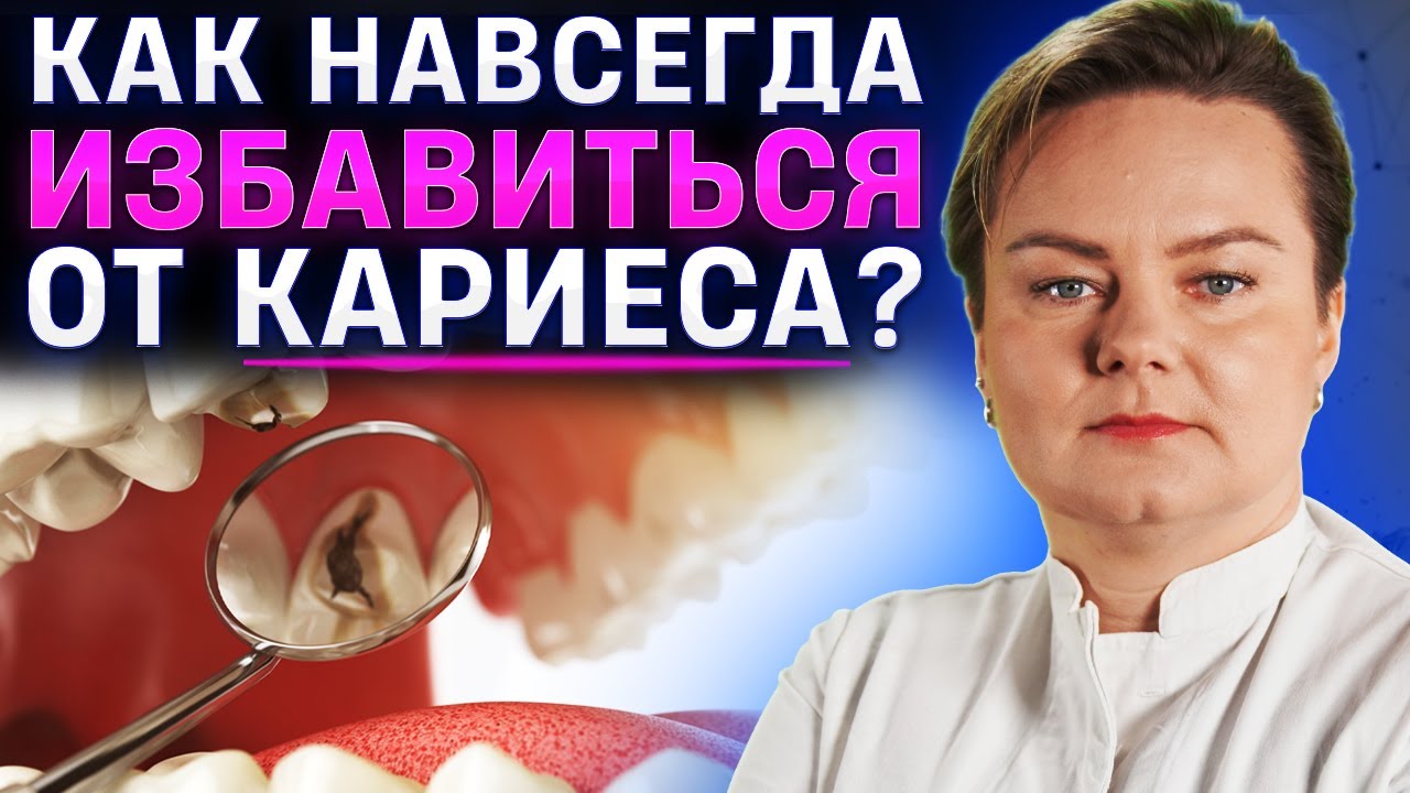 Кариес. Лечение и профилактика. Анастасия Казачек