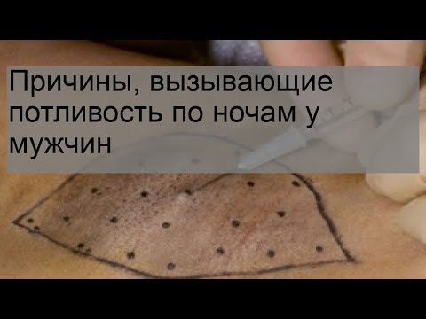 Причины, вызывающие потливость по ночам у мужчин