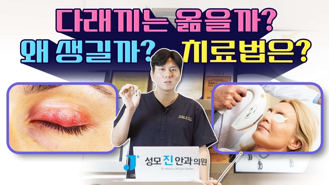 [Сонгмо Жин Нүдний Эмнэлэг] Загги яах ёстой вэ? [Анагаахын ухааны доктор Пак Жинхён, Тэргүүн эмч]