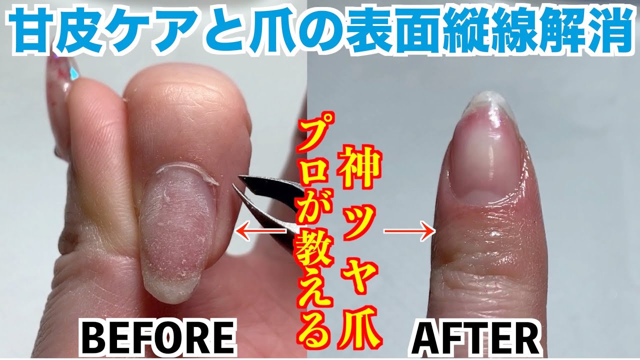 ネイルケア 甘皮ケアと爪の表面の縦線解消でツヤ爪になれる プロが教える簡単セルフケア Youtube ネイルケア 甘皮ケアと爪の表面の縦線解消でツヤ爪になれる プロが教える簡単セルフケア Youtube