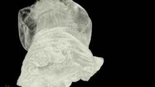 Metridium senile frilledseaanemone
