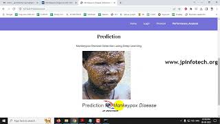 Monkeypox Disease Detection using Deep Learning | Python IEEE Machine Learning Final Year Project