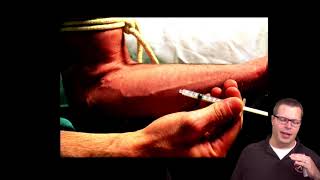 Cns Infections Part 1