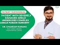 Ankle arthritis | Ankle Fusion | Successful Outcome | Dr Chandan Narang | Foot And Ankle Surgeon|