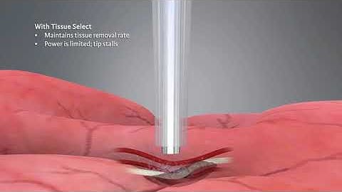 cusa excel tissueselect animation