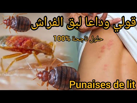 كيفية التخلص و القضاء على بق الفراش نهائيا طرق فعالة و ناجحة تقضي عليه 100   