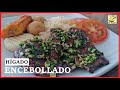 HÍGADO ENCEBOLLADO | RECETAS COLOMBIANAS