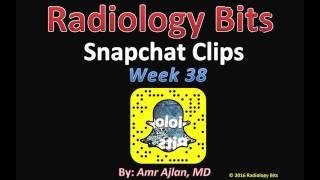 Celebrity RADIOLOGY BITS (SNAPCHAT WEEK 38) Profile