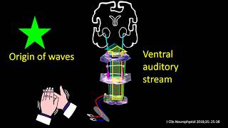 Old Brainstem auditory evoked potential