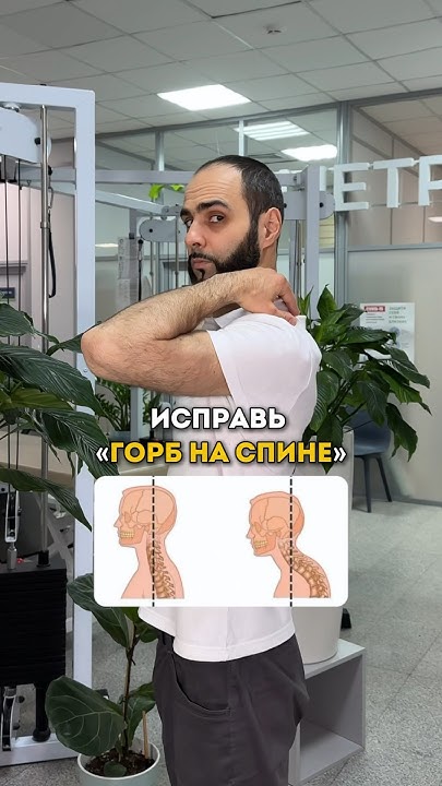 Исправь «Горб на спине». Пишите комментарии если было полезно. # ...