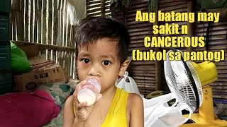 Ang batang may CANCEROUS (bukol sa pantog)