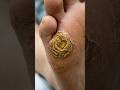Hiperqueratosis severa (un callo muy grueso y endurecido).