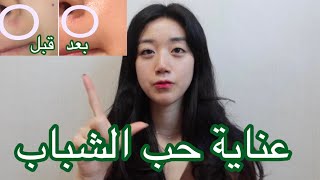 كيف يتم أزالة حب الشباب |  نصائح العناية بالبشرة من حب الشباب