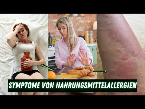 Video: Hautausschlag Bei Nahrungsmittelallergien: Andere Symptome, Behandlung Und Behandlungen