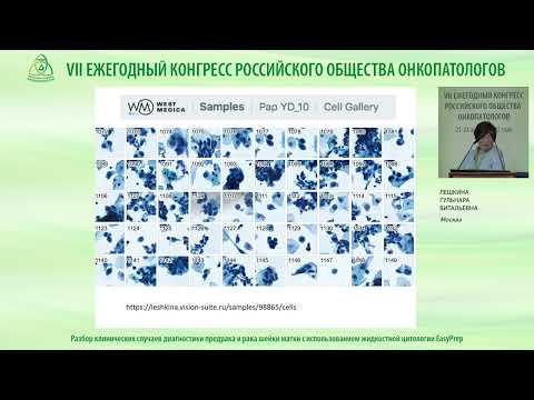 Разбор клинических случаев диагностики предрака и рака шейки матки с использованием цитологии