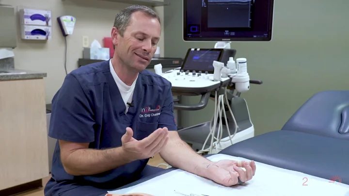 How Do I Know If I Have Carpal Tunnel Syndrome?