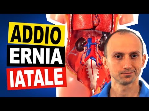 Video: Ernia Diaframmatica - Ernia Iatale: Trattamento E Chirurgia