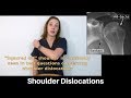Shoulder dislocation: presentation, physical exam, and imaging