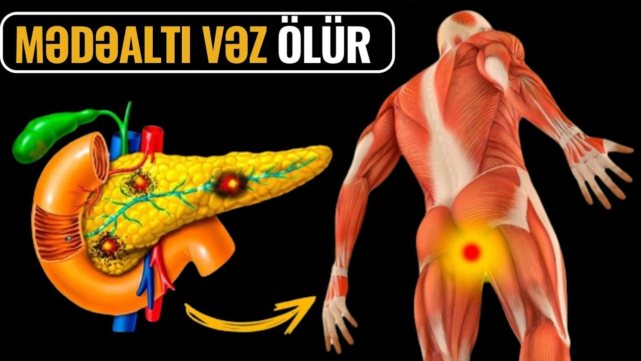Mədəaltı Vəzin Xəstə Olduğunu Göstərən 10 ƏLAMƏT