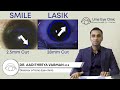 Smile and lasik laser vision correction explained by DR. AADITHREYA VARMAN MS | Uma eye clinic