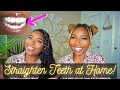 How to Fix Teeth at Home: Byte Journey| Affordable Quick & Easy| Impression Kit Demo| iamLindaElaine
