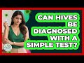 Can Hives Be Diagnosed With A Simple Test? - Allergy Relief Guide
