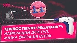 Відеоогляд герніостеплеру ReliaTack™ для фіксації сітчастих імплантатів при герніопластиці