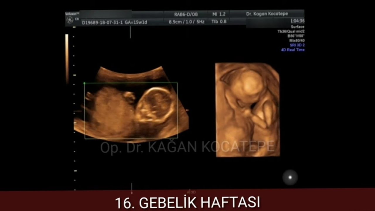 16 gebelik haftasinda 15 1 3 5 aylik kiz bebek ultrason goruntuleri c make it yourself video publishing