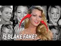 Blake Lively&#39;s Plastic Surgery: Not as Natural as You Think ...