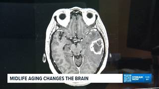 NIH-funded study finds midlife brain changes may help explain dementia risk