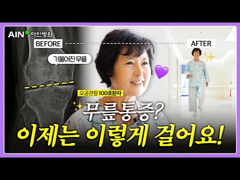 무릎인공관절 수술 후 어떤 변화가 있었을까? ｜⭐오공관절 100호환자에게 직접 물어봤습니다!⭐