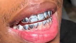 Ynw Antas Ft Junior King Stukkend En Verby Remix    