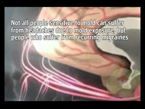 Can Household Mold Cause Headaches You Can Household Mold Cause Headaches