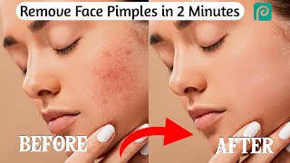 Skin Smoothing by photopea mobile app | Photopea |Photoshop| screenshot 4