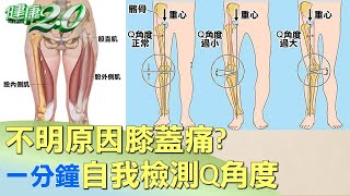 不明原因膝蓋痛? 一分鐘自我檢測Q角度 健康2.0